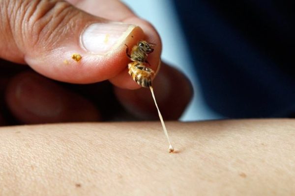 Como curar uma picada de abelha
